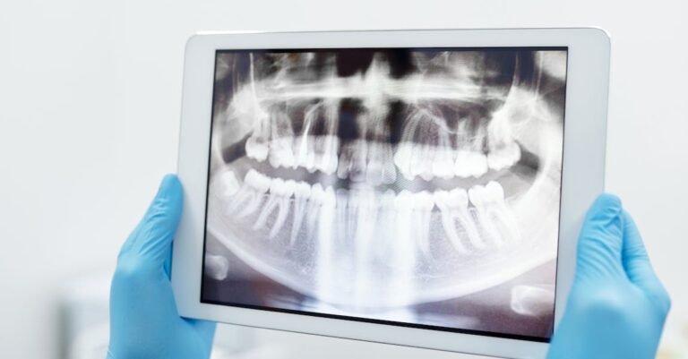 Whiten Your Teeth With These Easy